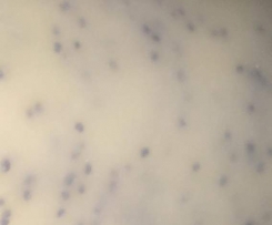 The BEST homemade Poppyseed Salad Dressing EVER!